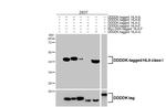 HLA Class I Antibody in Western Blot (WB)