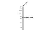 HNF1A Antibody in Western Blot (WB)