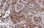 HRH1 Recombinant Rabbit Monoclonal Antibody (HL2783)