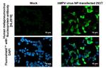 Metapneumovirus Nucleoprotein Recombinant Rabbit Monoclonal Antibody (HL2919)