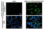 Metapneumovirus Nucleoprotein Recombinant Rabbit Monoclonal Antibody (HL2921)