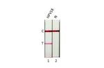 HPV Type 18 E7 Antibody in Lateral Flow (LF)