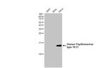 HPV Type 18 E7 Recombinant Rabbit Monoclonal Antibody (HL2522)