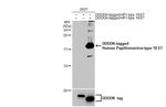 HPV Type 18 E7 Antibody in Western Blot (WB)