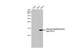 HPV Type 18 E7 Recombinant Rabbit Monoclonal Antibody (HL2787)