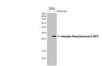 Human Parechovirus 1/3 VP3 (Strain: WA17c-06) Antibody in Western Blot (WB)