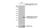 Human Parechovirus 3 VP3 (Strain: WA17c-06) Antibody in Western Blot (WB)