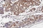 IL-2 Recombinant Rabbit Monoclonal Antibody (HL2645)