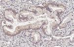 INSR beta Recombinant Rabbit Monoclonal Antibody (HL2737)