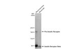 INSR beta Antibody in Western Blot (WB)