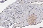 INSR beta Antibody in Immunohistochemistry (Paraffin) (IHC (P))