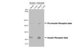 INSR beta Antibody in Western Blot (WB)