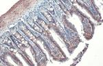 ITGB1 Antibody in Immunohistochemistry (Paraffin) (IHC (P))