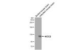KCC2 Recombinant Mouse Monoclonal Antibody (GT16)