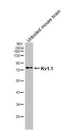 KV1.1 (KCNA1) Antibody in Western Blot (WB)