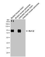 KV1.2 (KCNA2) Antibody in Western Blot (WB)