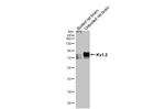 KV1.2 (KCNA2) Antibody in Western Blot (WB)