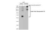 Lassa Virus Glycoprotein G1 (strain Mouse/Sierra Leone/Josiah/1976) Antibody in Western Blot (WB)