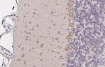 LC3B Antibody in Immunohistochemistry (Paraffin) (IHC (P))