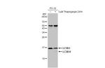 LC3B Antibody in Western Blot (WB)