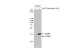 LC3B Antibody in Western Blot (WB)