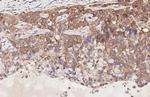 LGR6 Antibody in Immunohistochemistry (Paraffin) (IHC (P))