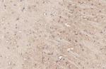 MC4R Antibody in Immunohistochemistry (Paraffin) (IHC (P))