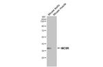 MC5R Recombinant Rabbit Monoclonal Antibody (HL3178)