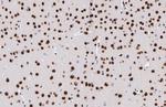 MEF2C Antibody in Immunohistochemistry (Paraffin) (IHC (P))