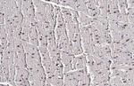 MEF2C Antibody in Immunohistochemistry (Paraffin) (IHC (P))