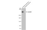 mGluR5 Antibody in Western Blot (WB)