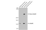 mGluR5 Antibody in Western Blot (WB)