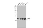 MIF Recombinant Rabbit Monoclonal Antibody (HL2964)