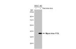 Monkeypox Virus F13L (MPXV/USA/2022/MA001) Antibody in Western Blot (WB)