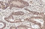 MRE11 Antibody in Immunohistochemistry (Paraffin) (IHC (P))
