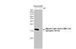 Phospho-MYL2 (Ser15) Antibody in Western Blot (WB)