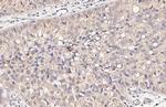 CALCOCO2 Antibody in Immunohistochemistry (Paraffin) (IHC (P))