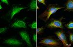 OGDH Recombinant Rabbit Monoclonal Antibody (HL2072)
