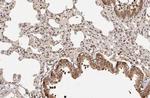 p27Kip1 Antibody in Immunohistochemistry (Paraffin) (IHC (P))
