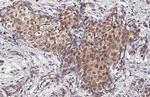 Phospho-p38 MAPK (Tyr182) Antibody in Immunohistochemistry (Paraffin) (IHC (P))