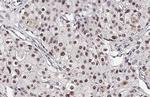 Phospho-p38 MAPK (Tyr182) Antibody in Immunohistochemistry (Paraffin) (IHC (P))