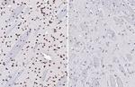 Phospho-p38 MAPK (Tyr182) Antibody in Immunohistochemistry (Paraffin) (IHC (P))