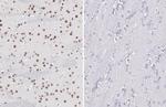 Phospho-p38 MAPK (Tyr182) Antibody in Immunohistochemistry (Paraffin) (IHC (P))