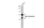 Cytokeratin Pan Type I/II Antibody in Western Blot (WB)