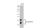 Cytokeratin Pan Type I/II Recombinant Rabbit Monoclonal Antibody (HL2321)