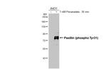 Phospho-Paxillin (Tyr31) Antibody in Western Blot (WB)