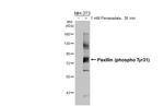 Phospho-Paxillin (Tyr31) Antibody in Western Blot (WB)