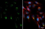 PCSK9 Recombinant Rabbit Monoclonal Antibody (HL2814)