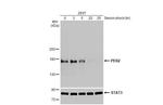 PER2 Recombinant Rabbit Monoclonal Antibody (HL2775)