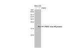 PRRS Virus M Protein (Strain: VR-2322) Recombinant Rabbit Monoclonal Antibody (HL2575)